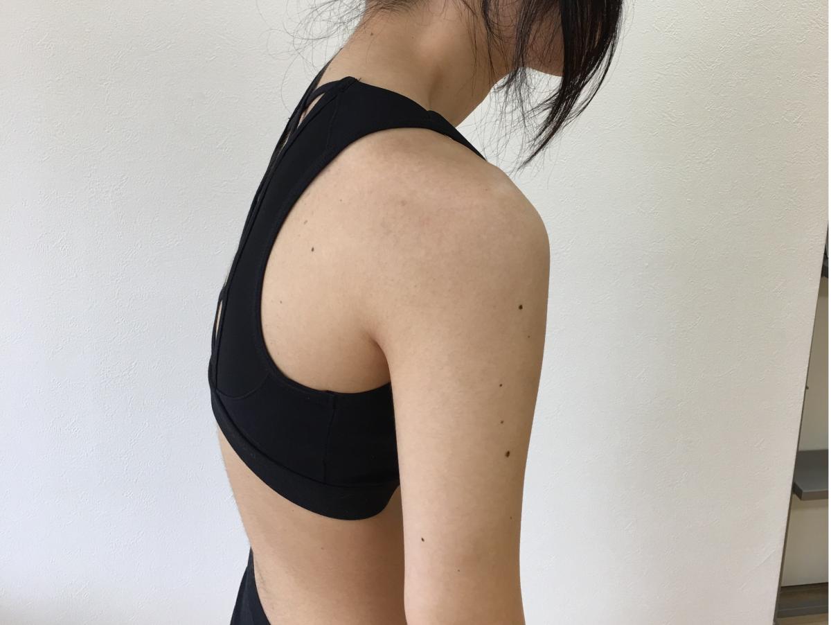 見た目だけでなく健康にも影響する猫背。猫背を改善して健康で痩せ体質になりましょう。
